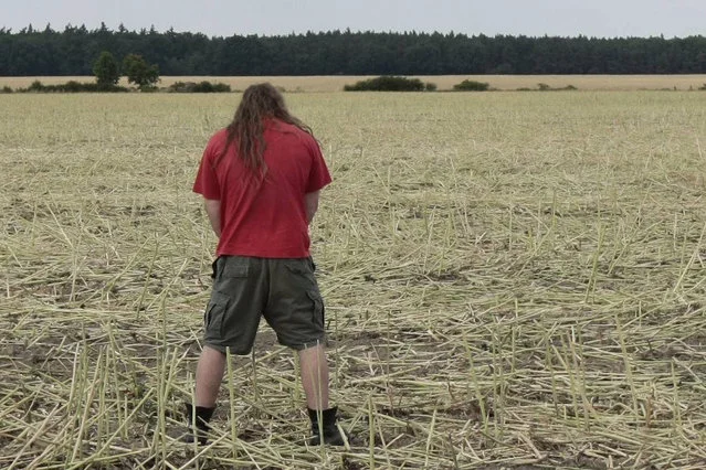 Krwiomocz pojawia się już przy zaawansowanym raku nerki. Dzięki badaniom USG można ten nowotwór wykryć na wczesnym etapie.