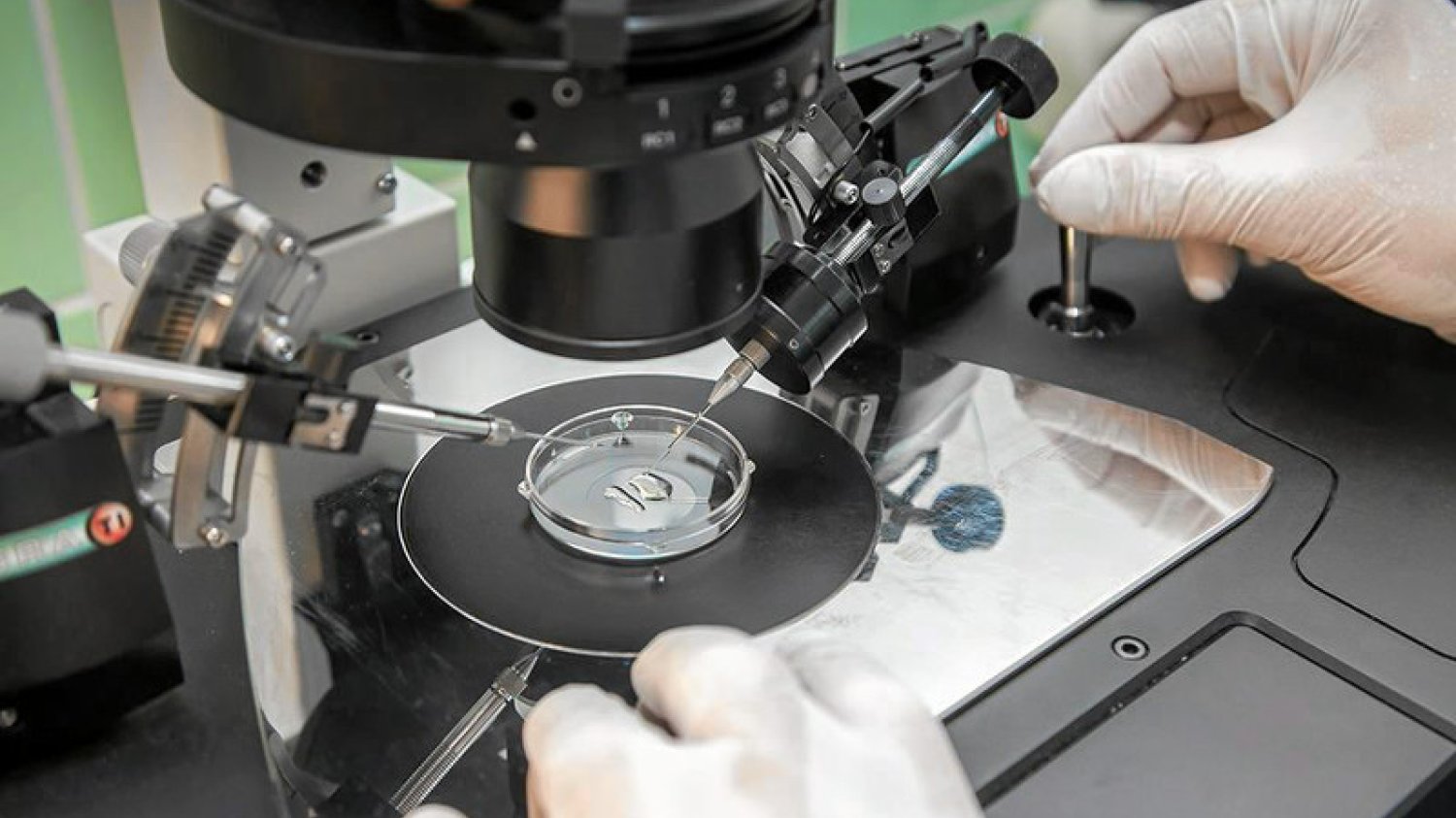 Procedura in vitro.