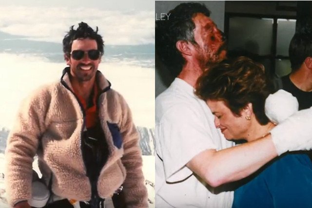 Beck Weathers w trakcie wspinaczki i tuż po powrocie z Everestu.