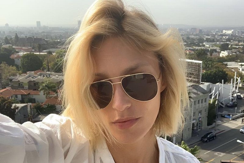 Anja Rubik pokazała na InstaStories, jak przypala papierosem miejsca po ukąszeniach komara.