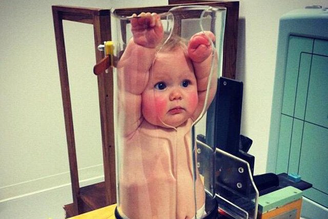 Zdjęcie wykonano przy okazji wykonywania zdjęć rentgenowskich