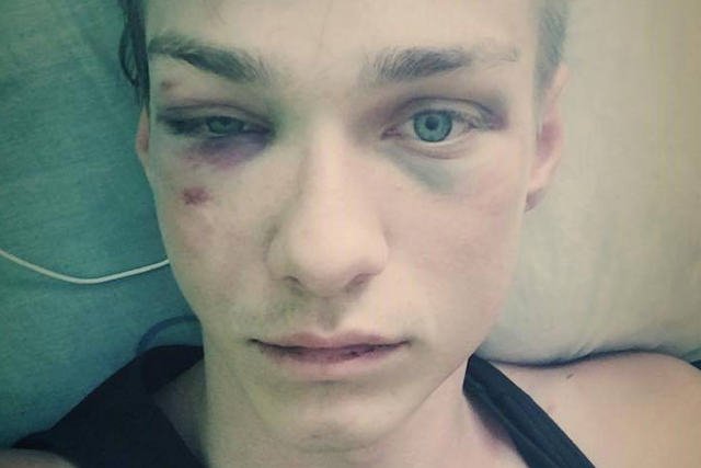 Polski model, próbuje odnaleźć swoich oprawców