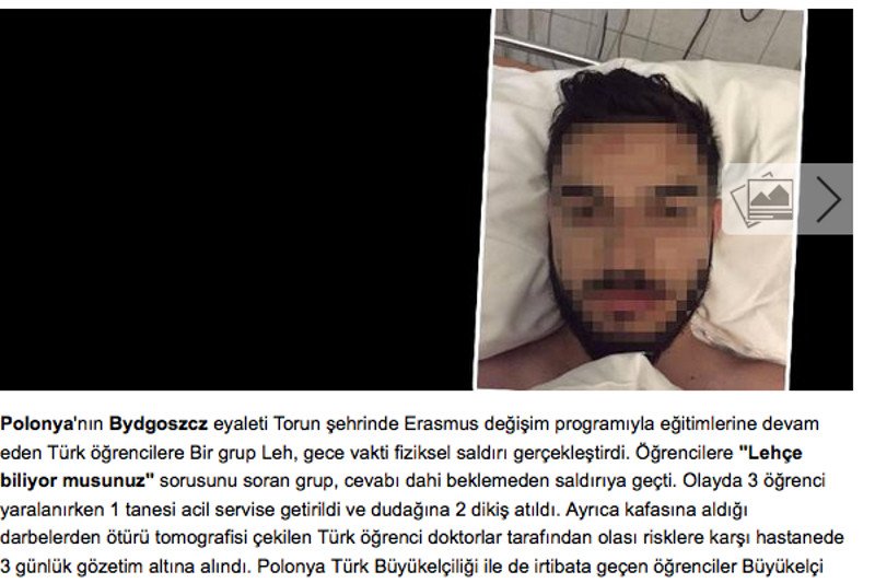 Turecki portal donosi o pobiciach studentów w Bydgoszczy. Co jest nie tak z tym miastem?