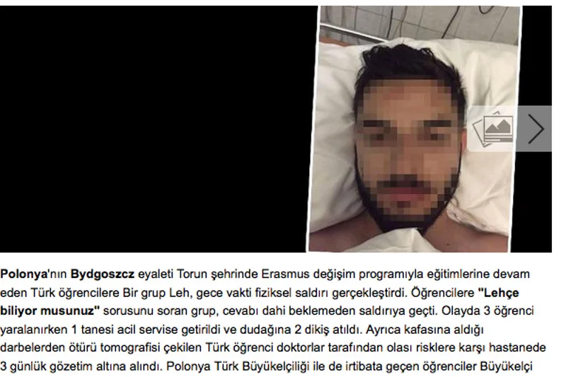 Turecki portal donosi o pobiciach studentów w Bydgoszczy. Co jest nie tak z tym miastem?