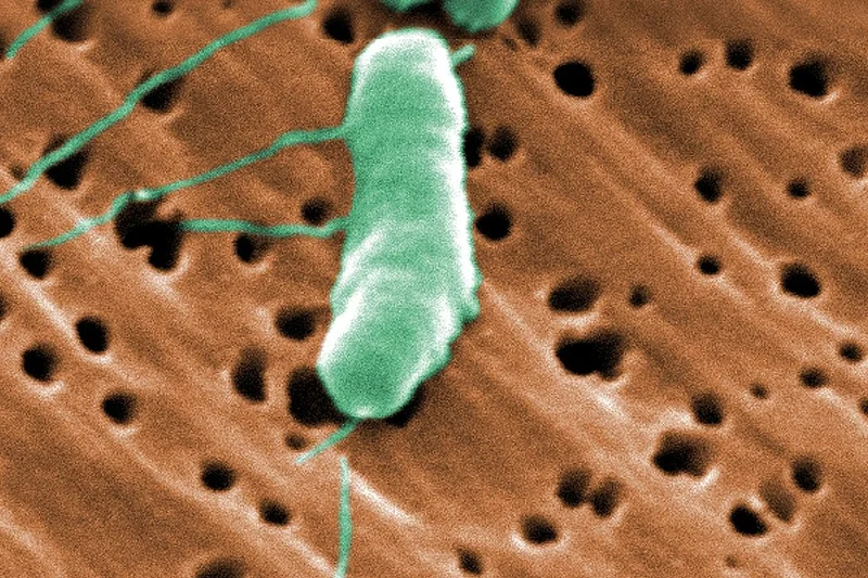 Bakteria przecinkowca gatunku Vibrio vulnificus. Obraz ze skaningowego mikroskopu elektronowego (SEM)