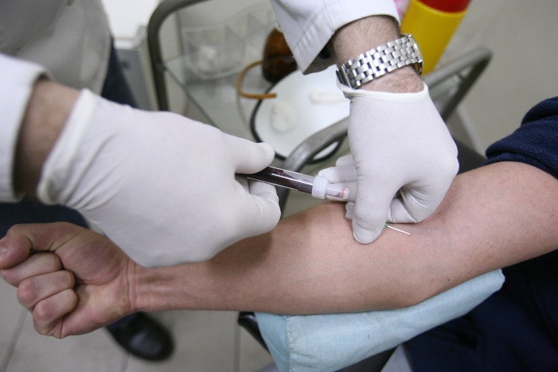 Część ludzi w Polsce, którzy są zarażeni wirusem HIV, nie ma już dostępu do leków – alarmuje wykładowca Uniwersytetu Warszawskiego, dr Jacek Kochanowski.