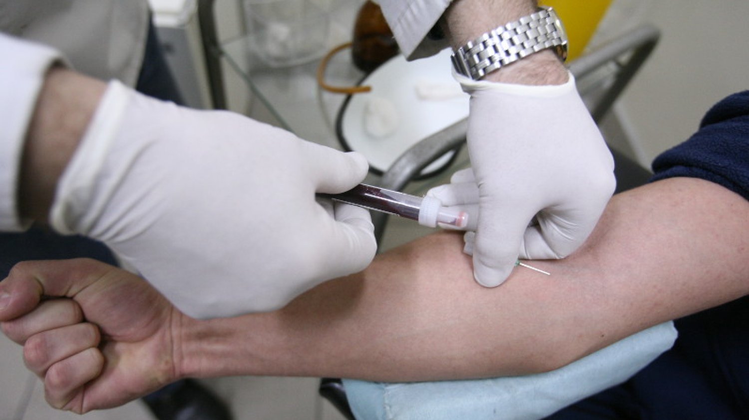 Część ludzi w Polsce, którzy są zarażeni wirusem HIV, nie ma już dostępu do leków – alarmuje wykładowca Uniwersytetu Warszawskiego, dr Jacek Kochanowski.