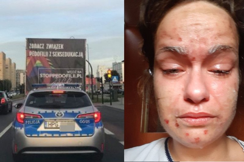 Kierowca furgonetki potraktował aktywistkę gazem pieprzowym. Kobieta miała podobno na niego napaść.