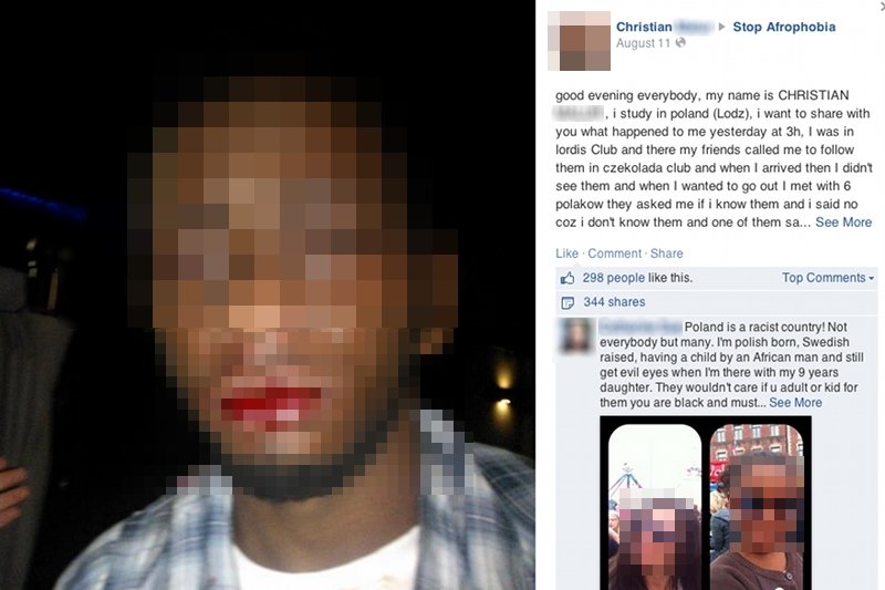 Christian, student z Konga został pobity w jednym z łódzkich klubów. Ochrona nie zareagowała
