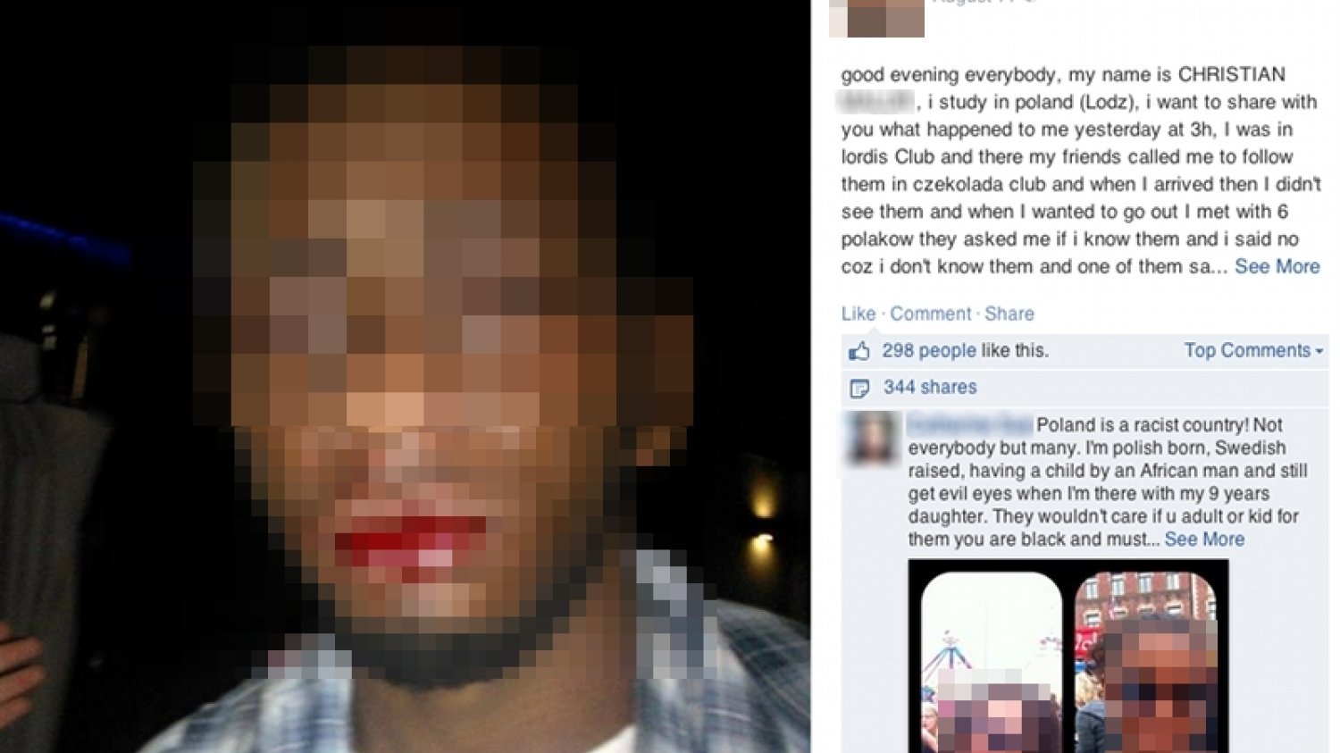 Christian, student z Konga został pobity w jednym z łódzkich klubów. Ochrona nie zareagowała