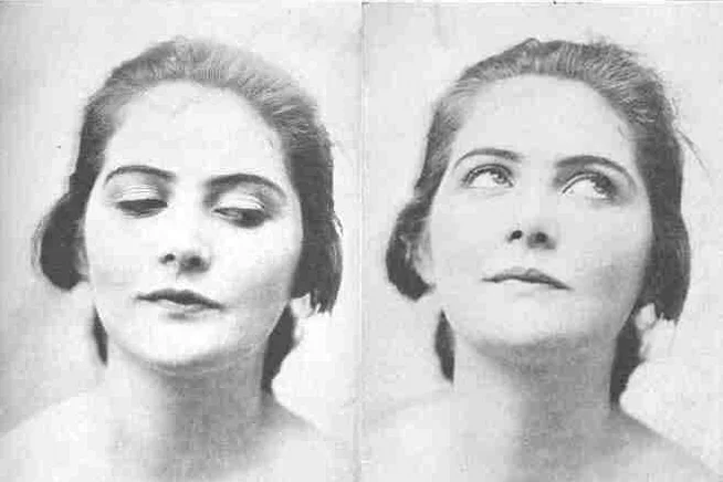 Zdjęcia z książki Williama Batesa "Perfect Sight Without Glasses" (idealny wzrok bez okularów)
