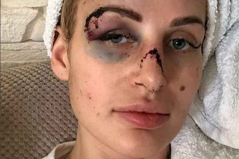 Katarzyna miała zostać skatowana przez swojego partnera, znanego w Trójmieście trenera personalnego.