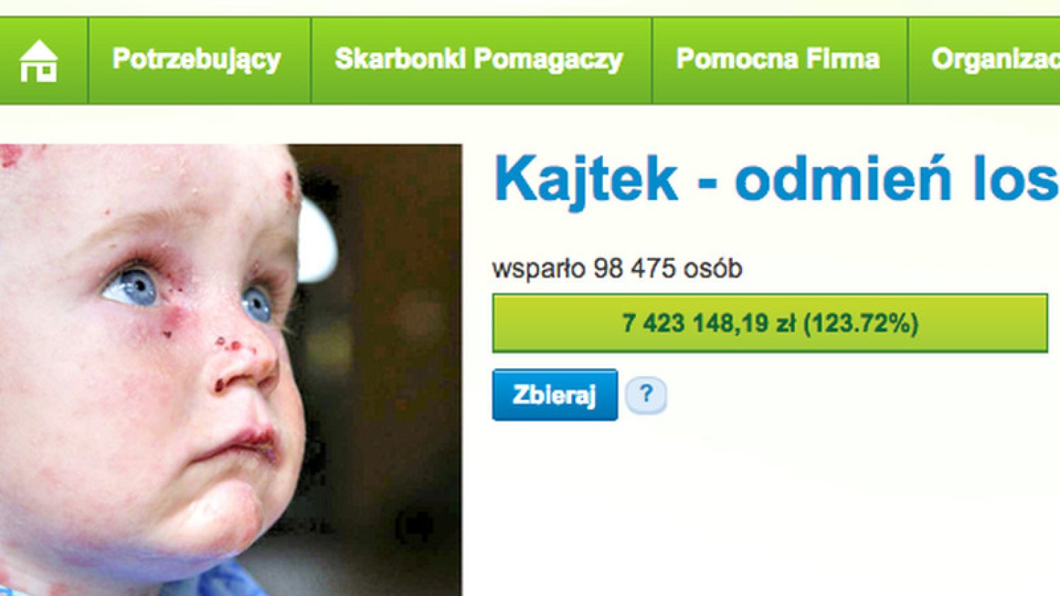 Internauci zebrali już ponad 7 mln zł na leczenie Kajtka.