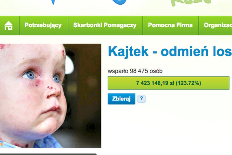 Internauci zebrali już ponad 7 mln zł na leczenie Kajtka.