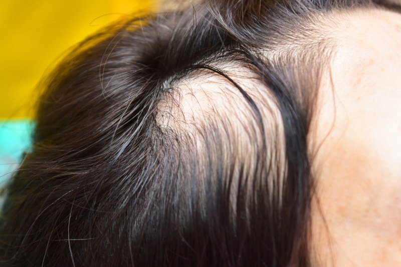 Zdjęcie ilustracyjne.