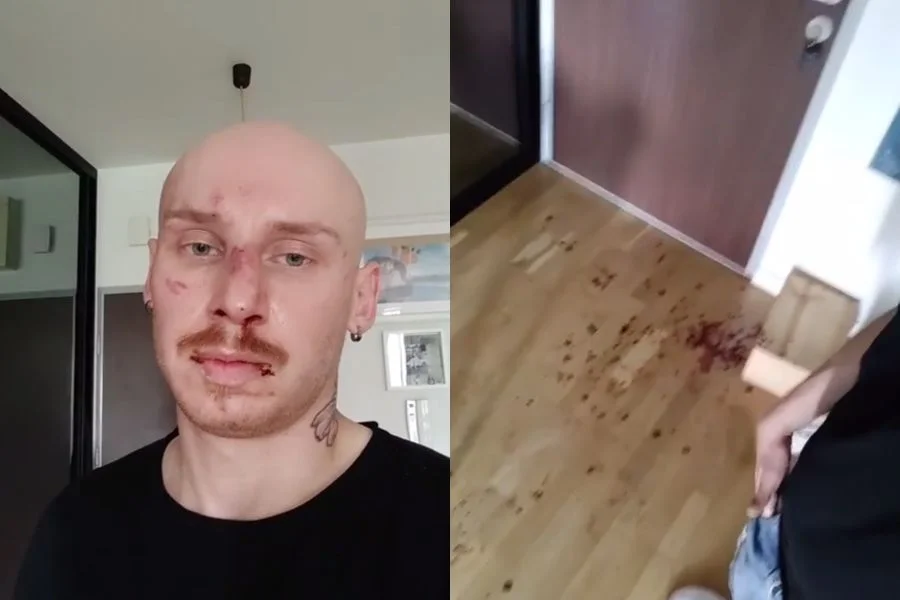 Jacek Szawioła został dotkliwie pobity przed własnym domem