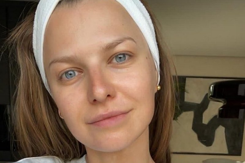 Anna Lewandowska zdradziła, dlaczego ma taką cerę? [FOTO]