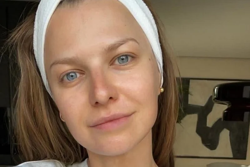 Anna Lewandowska zdradziła, dlaczego ma taką cerę? [FOTO]