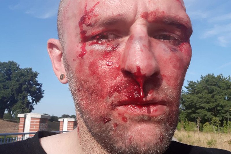 Przemysław Witkowski został pobity, bo zwrócił uwagę na homofobiczne napisy nad Odrą we Wrocławiu.