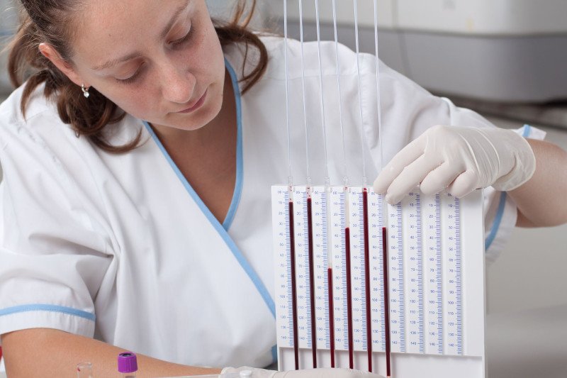 Badanie OB jest jednym z ważnych badań, które należy wykonać przy podejrzeniu szpiczaka mnogiego