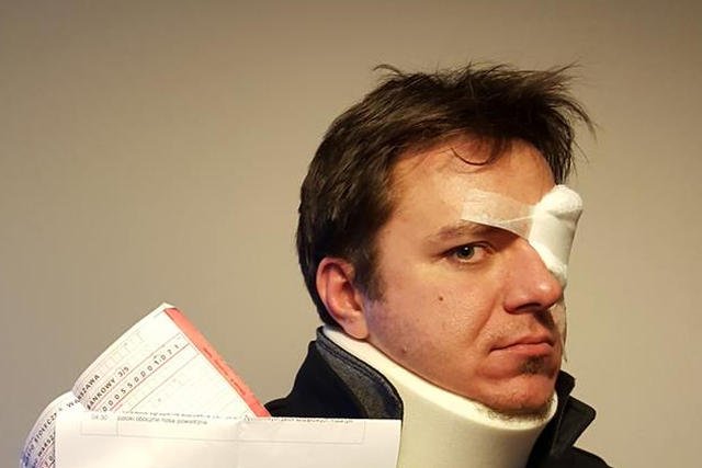 Paweł Surgiel został pobity przez strażników miejskich, grozili mu śmiercią