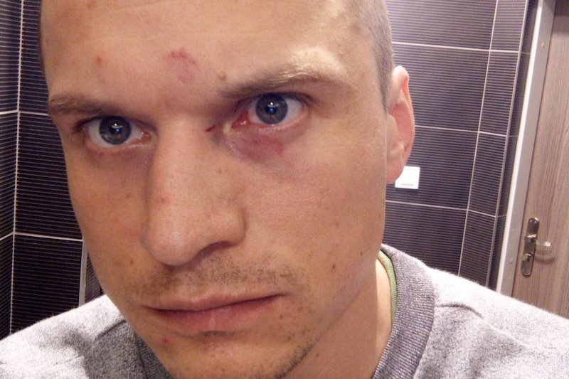 Fotoreporter Jakub Szafrański został zaatakowany podczas zgromadzenia społeczności LGBT w Warszawie.