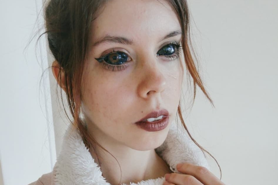 O nieudanym zabiegu tatuowania oczu na czarno mówiła cała Polska. Jak teraz sobie radzi 25-letnia Aleksandra?