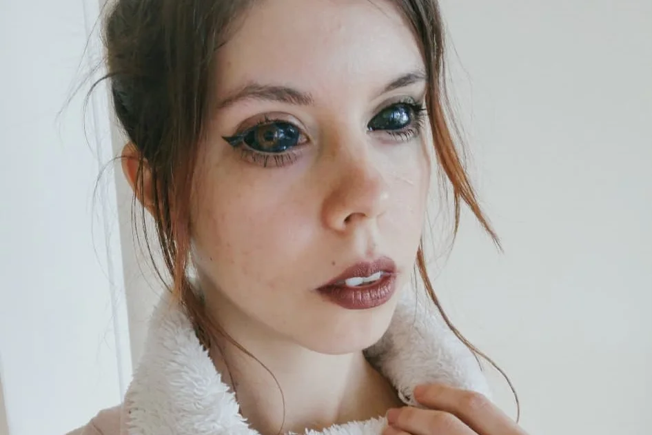O nieudanym zabiegu tatuowania oczu na czarno mówiła cała Polska. Jak teraz sobie radzi 25-letnia Aleksandra?