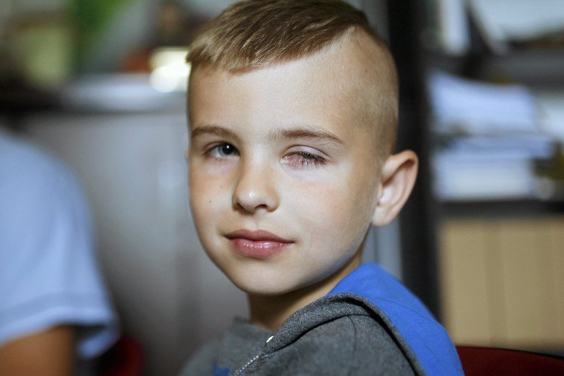 Jakub Baleński, któremu przeszczepiono komórki rąbka rogówki. Dzięki temu zabiegowi chłopiec odzyskał wzrok, który stracił po oparzeniu wapnem.