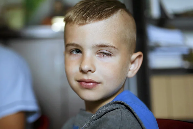 Jakub Baleński, któremu przeszczepiono komórki rąbka rogówki. Dzięki temu zabiegowi chłopiec odzyskał wzrok, który stracił po oparzeniu wapnem.
