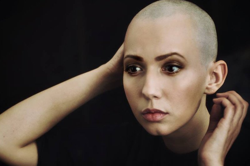 Marzena Erm na chłoniaka Hodkina choruje od 4 lat