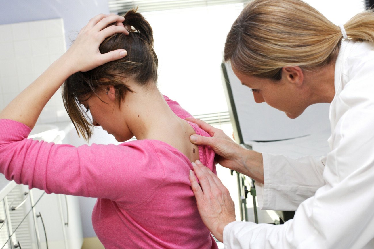 Podejrzane znamiona skórne warto pokazać dermatologowi