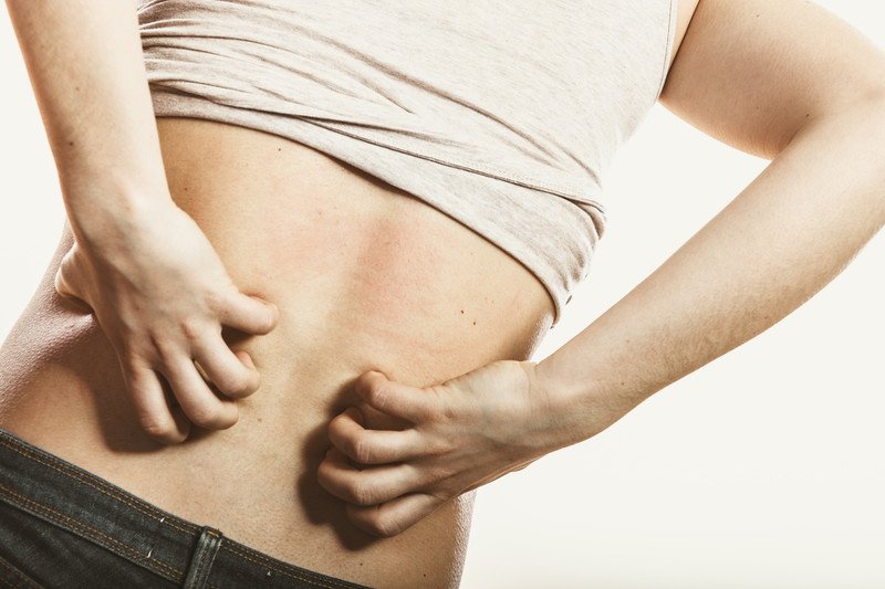 Swędzenie może doprowadzić do szału dorosłego a co dopiero mówić o dziecku.