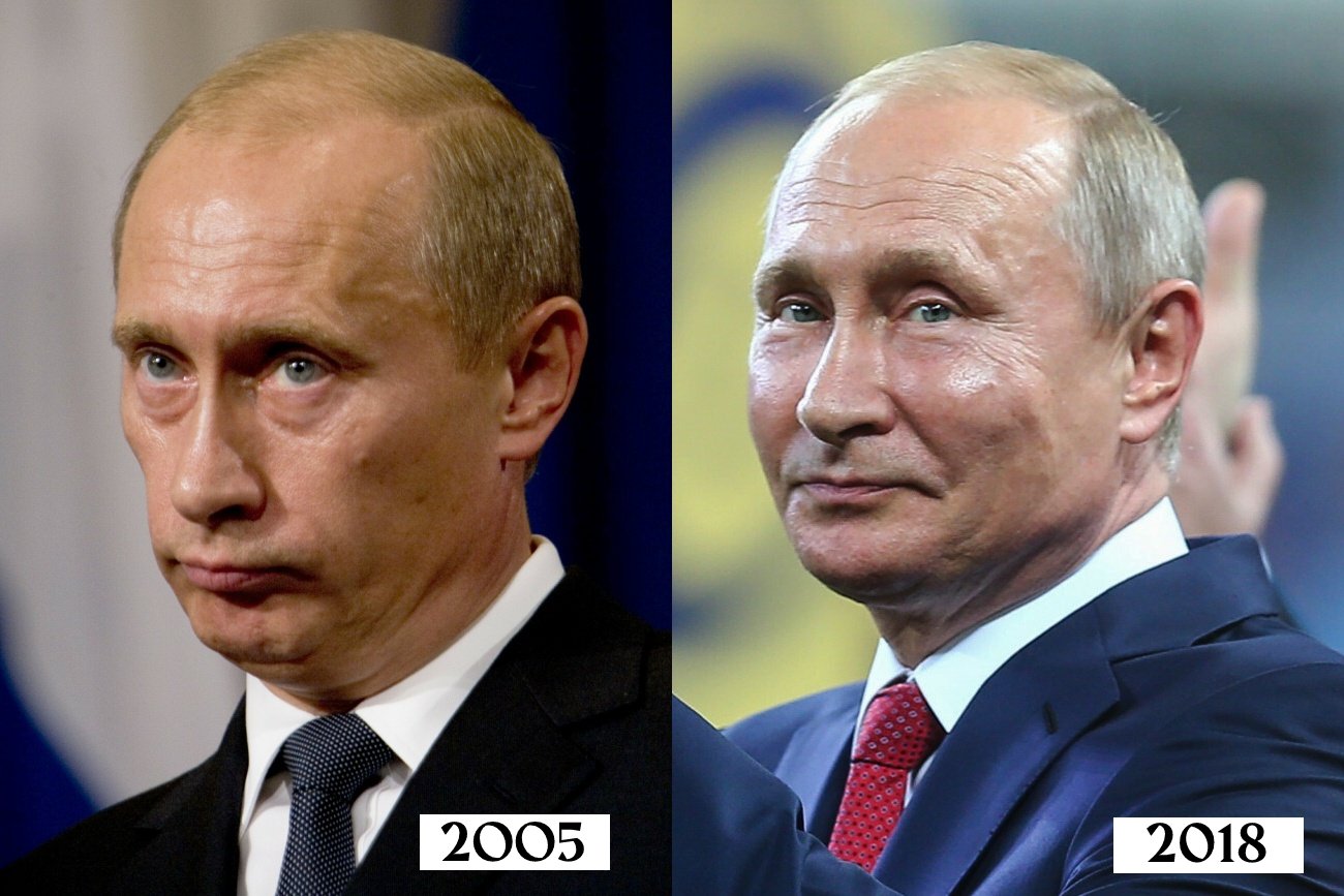 Jakie operacje plastyczne miał Władimir Putin? Nie tylko botoks