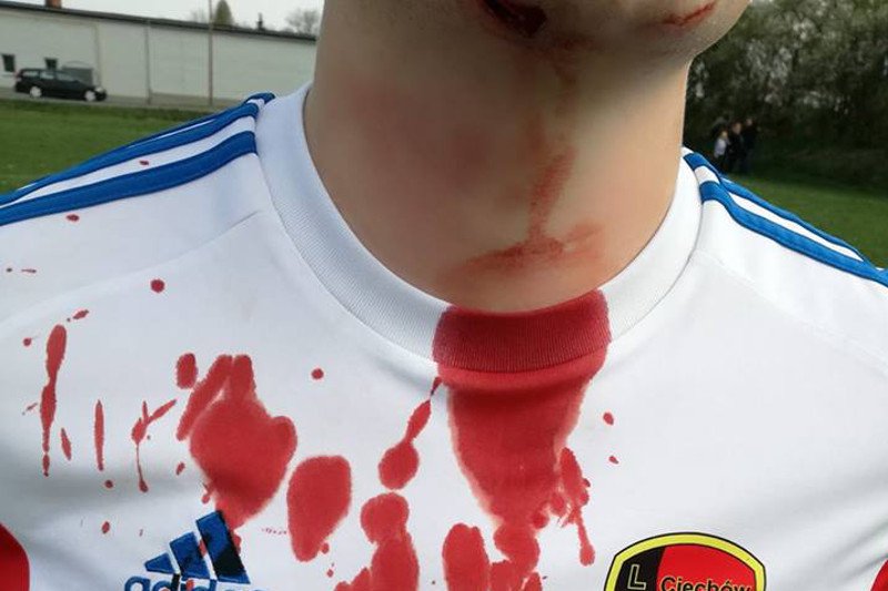 Jeden z kibiców próbował poderżnąć piłkarzowi gardło.