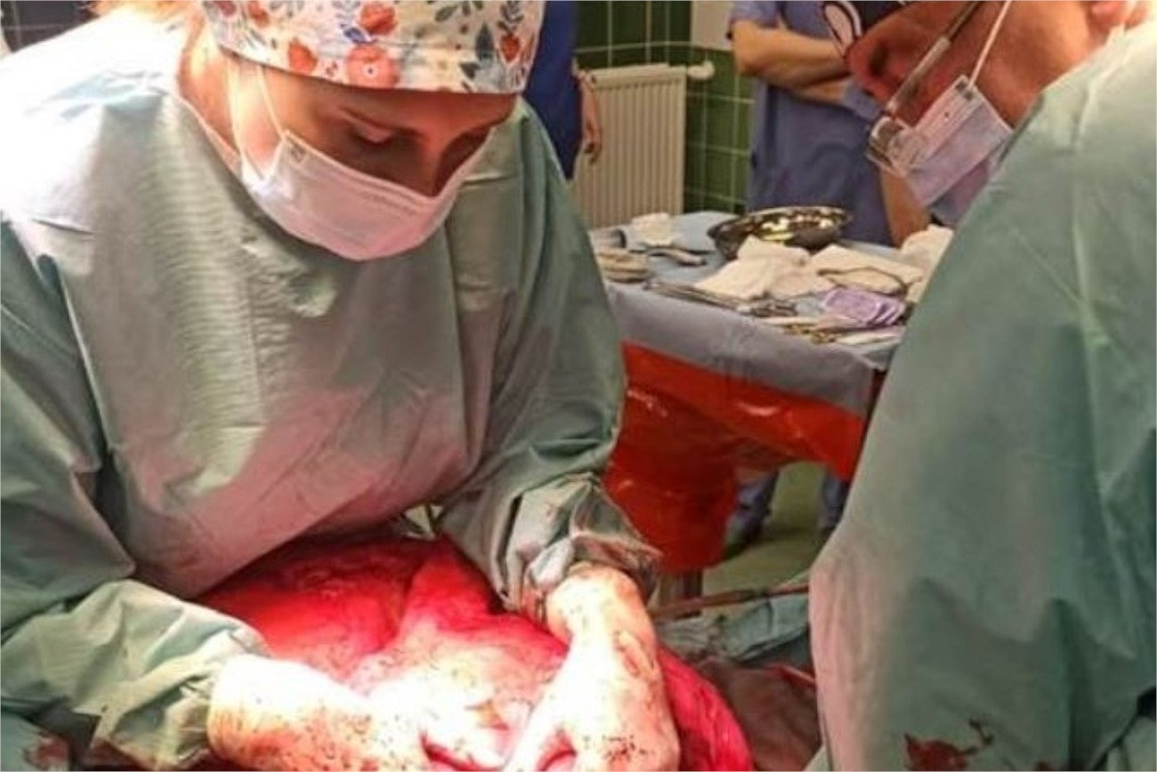 Niecodzienna operacja trwała ponad 7 godzin