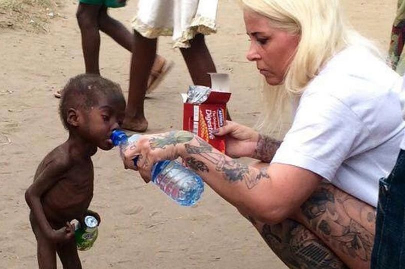 Wychudzony mały chłopiec ma już za sobą trudne momenty. Co dzieje się z nim teraz?