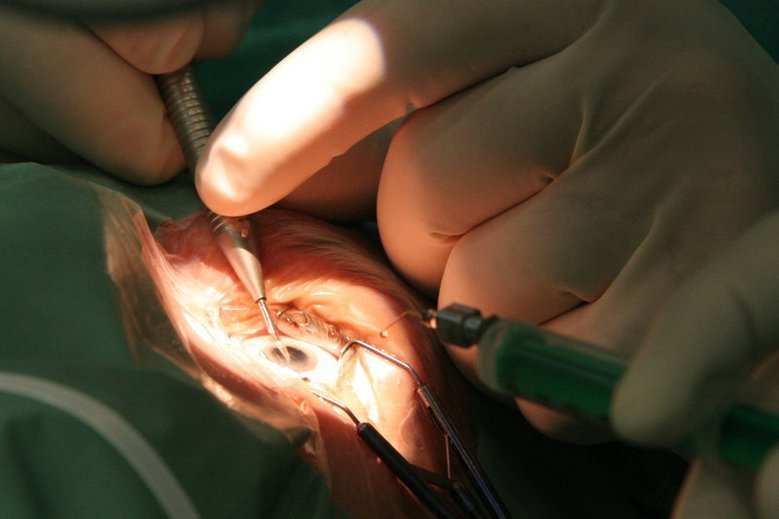 Zapalenie błony naczyniowej oka najczęściej pojawia się u osób pomiędzy 20. a 40. rokiem życia. Zdjęcie jest tylko ilustracją do tekstu.