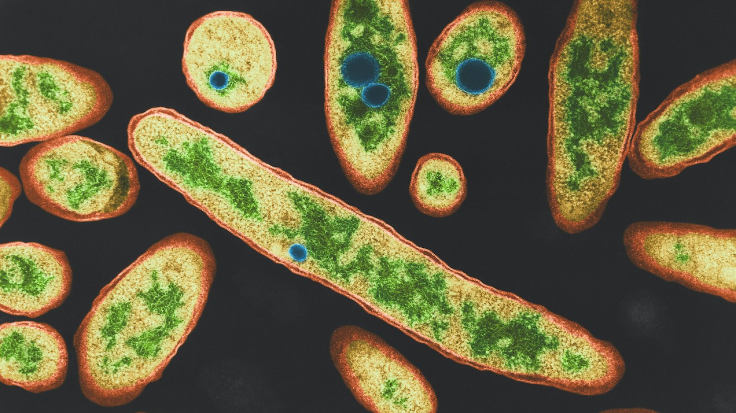 Bakteria Legionella pod mikroskopem.