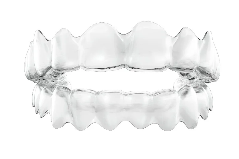 Alternatywą dla tradycyjnych aparatów na zęby są dopasowane indywidualnie do pacjenta przezroczyste nakładki zaprojektowane w technologii Invisalign
