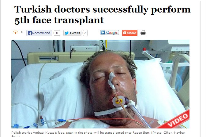 Twarz polskiego turysty przeszczpiono 27-letniemu Turkowi