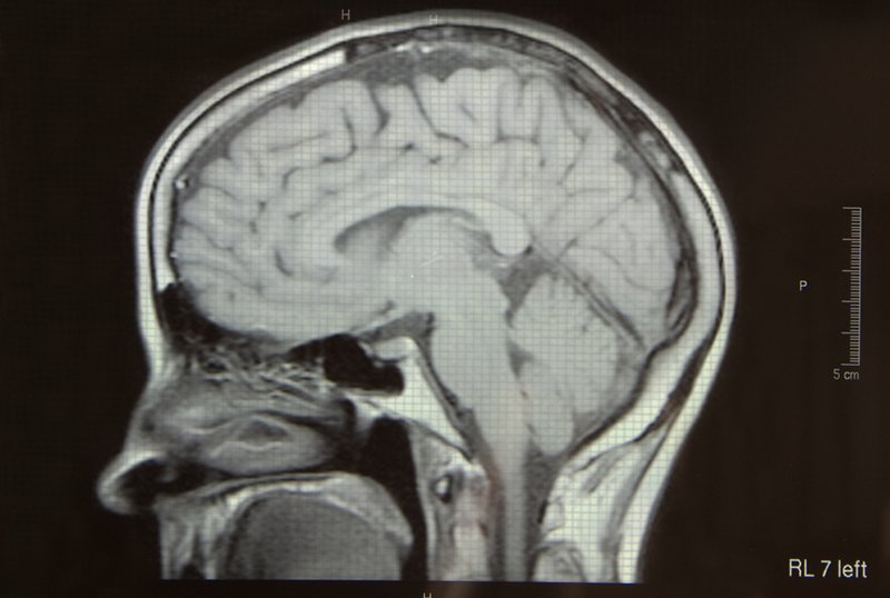 Aż 20 proc. Polaków ma [url=http://tinyurl.com/mjk3ch7]zaburzenia psychiczne[/url].