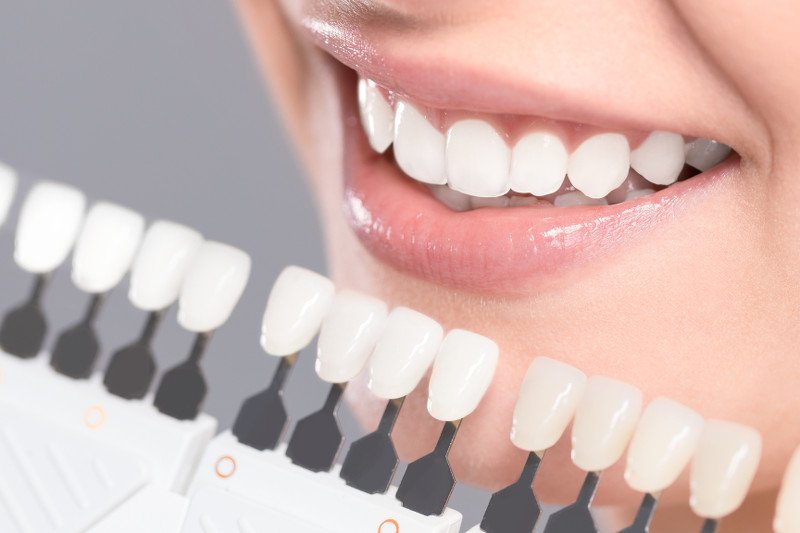 Lepiej nie eksperymentować i wybielanie zębów pozostawić dentyście lub higienistce stomatologicznej.