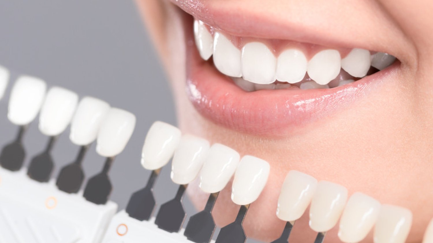 Lepiej nie eksperymentować i wybielanie zębów pozostawić dentyście lub higienistce stomatologicznej.