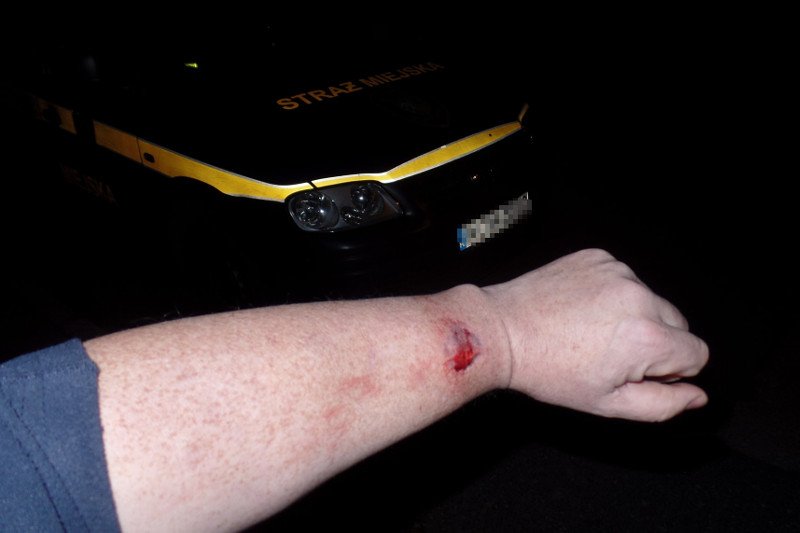 Mężczyzna, który twierdzi, że został pogryziony przez szefową sztabu Andrzeja Dudy, prezentuje dowody.