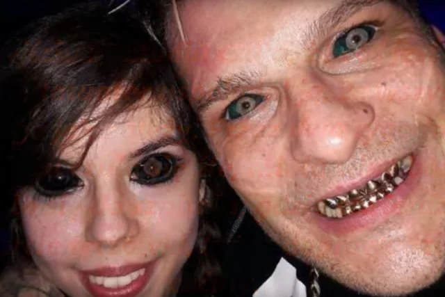 23-letnia wrocławianka traci wzrok na skutek tatuażu gałek ocznych. Kobieta chciała upodobnić się do swojego idola, rapera Popka.