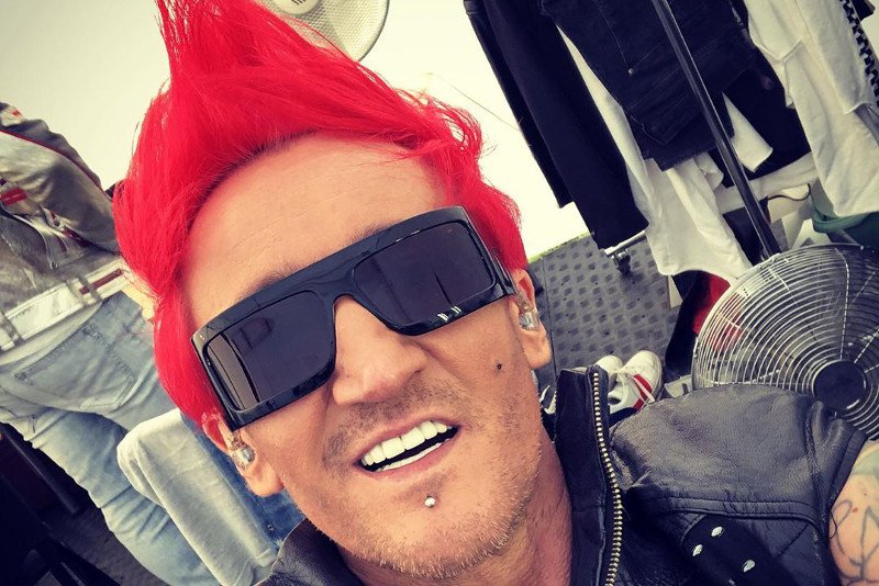 Michał Wiśniewski pokazał usuwanie tatuażu z imieniem Dominiki Tajner.