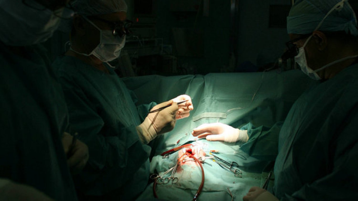 Ubezpieczenie od raka, skomplikowane operacje kardiochirurgiczne, odbudowa stawów - to wszystko weszło do abonamentów medycznych. Ich cena jest porównywalna ze składką do NFZ