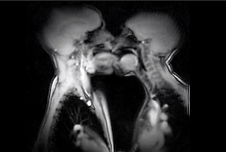Naukowcom z Northwestern University udało się dokonać przełomowego odkrycia dotyczącego pożądania u mężczyzn. Okazuje się, że odpowiada za to aromataza. Co to jest? Co to jest aromataza? Naukowcy odkryli obszar kontrolujący męskie pożądanie