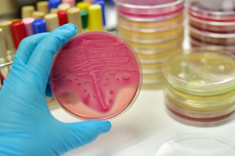 Antybiotyki potrafią skutecznie "zabić" dobrą florę bakteryjną w jelitach.
